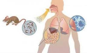 Seremi de Salud confirma primer caso fallecido por Hantavirus en la Región de Los Ríos